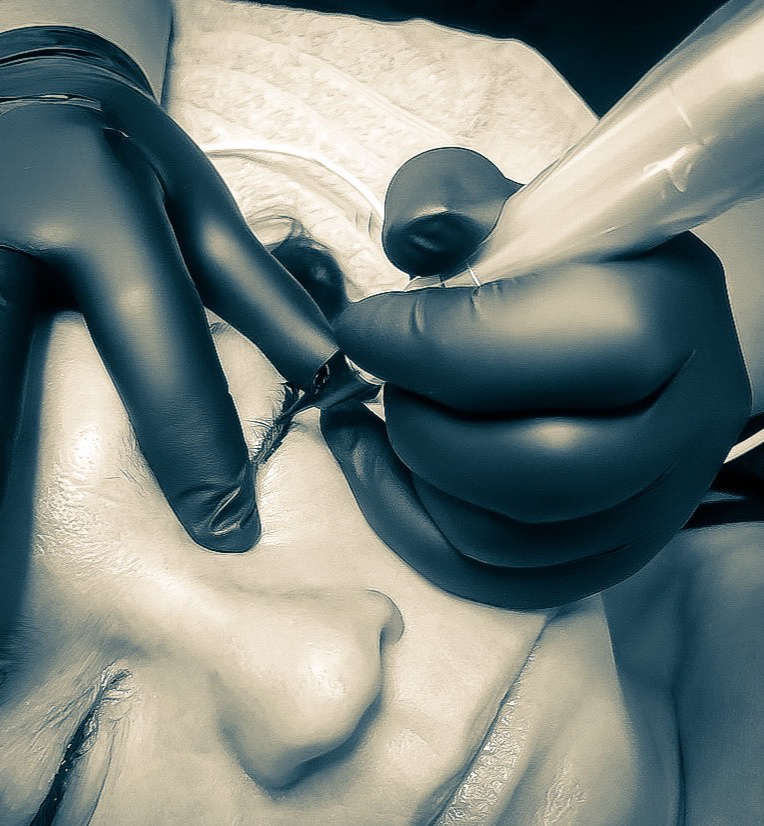 Permanent eyeliner